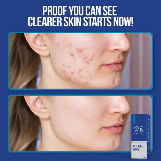 Clear Skin, New Confidence – In Just Days!